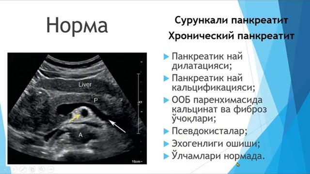Ошқозон ости бези ультратовуш текшируви 2,5 минутда. УЗИ поджелудочной железы за 2,5 минут. смотреть онлайн