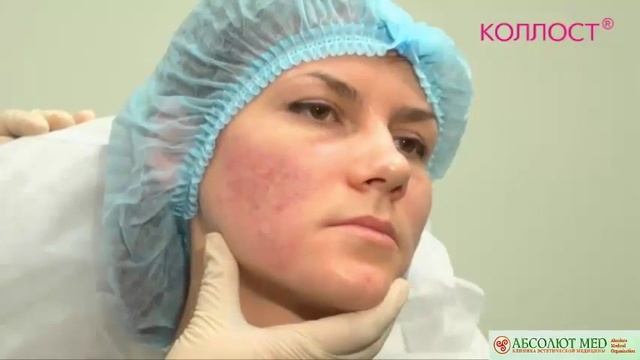 Коллост