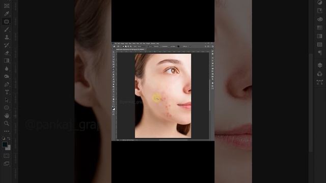 How to Remove Acne in Photoshop/Remove Blemishes, Wrinkles, Acne Scars, Dark Spots (Easily)#shorts