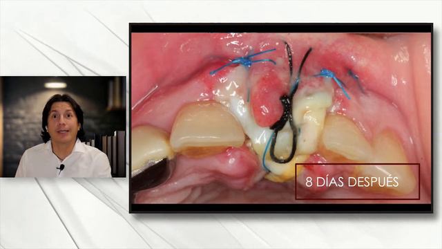 Charla de cirugía en directo Lunes, 11-Marzo-2024 смотреть онлайн