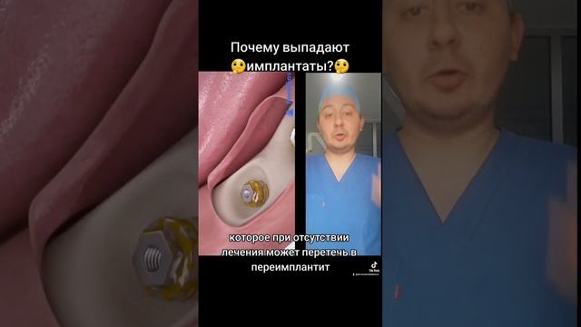 Почему выпадают импланты? #стоматолог #стоматология #имплант #имплантациязубов #имплантаты #имплант
