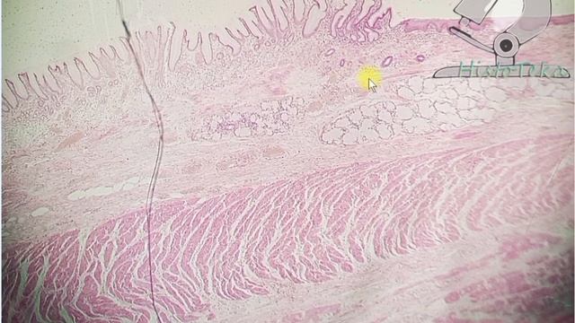 Переход пищевода в желудок смотреть онлайн