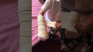 Самостоятельное надевание пластикового гипса