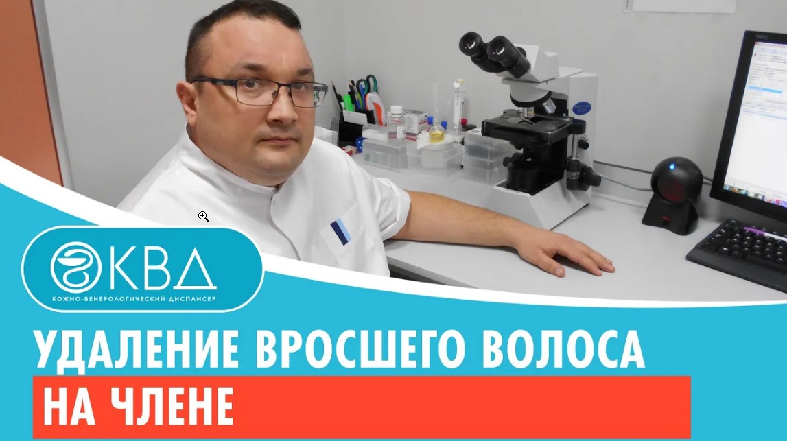 ✅ Удаление вросшего волоса на члене. Клинический случай №579