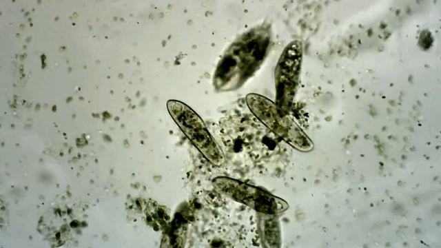 sempre Paramecium sp. смотреть онлайн
