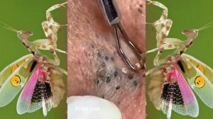 Relax squeezing out blackheads #25 Черные точки