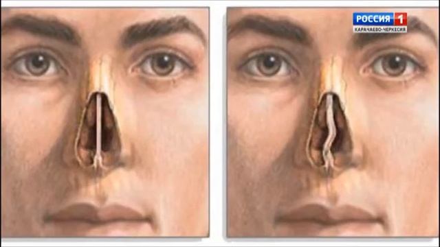 "Будем здоровы" смотреть онлайн