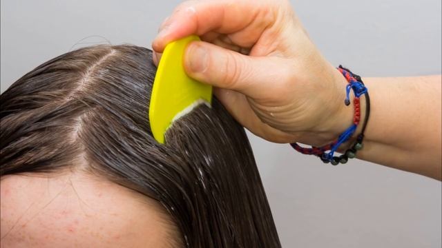 Как быстро избавиться от вшей? смотреть онлайн