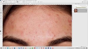 Восстанавливающая кисть в Фотошопе [Как пользоваться восстанавливающей кистью - инструкция]