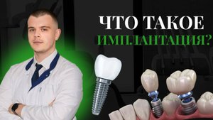 Что такое имплантация