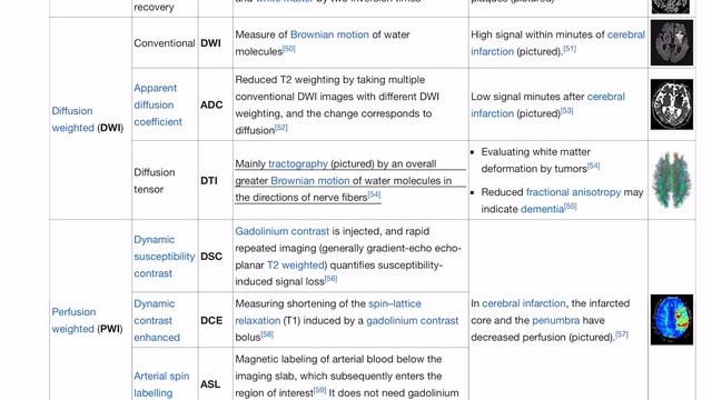 Magnetic resonance imaging (MRI) - Wikipedia