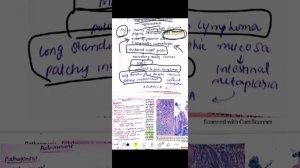 Git pathology 10 | chronic gestritis ( h pylori and antoimmune) | special pathology | Dr Zubia