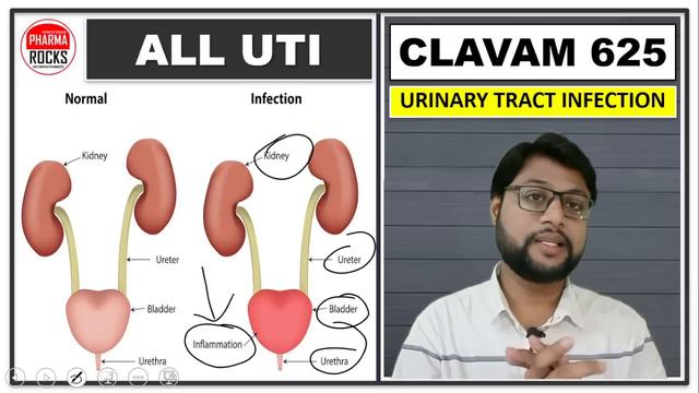 10 बीमारी की एक दवा हैं क्लैवम 625 💊 दवा की पूरी जानकारी सरल भाषामें💊 CLAVAM 625 TABLET IP, смотреть онлайн