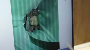 Фотопротокол лечение кариеса молочных зубов у детей