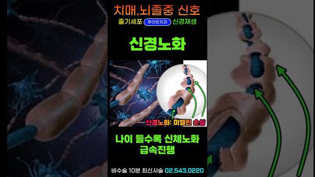 내몸이 알려주는 치매 뇌졸중 파킨슨병 심장질환 신호 8가지💥얼굴부종 귓볼주름 혀백태 탈모 눈충혈 팔자주름 침샘부음