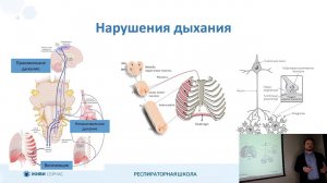 3.1 Механизмы развития дыхательной недостаточности при БАС и других нейромышечных заболеваниях