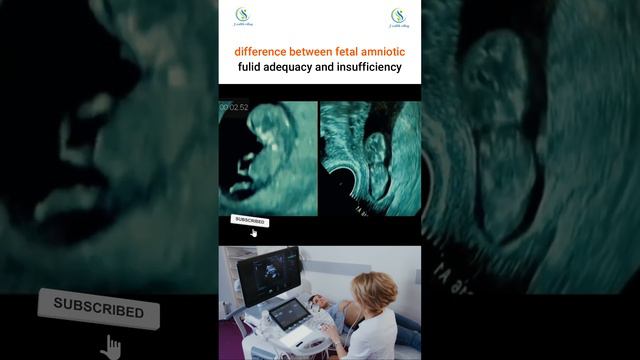 How many weeks are you pregnant? #pregnant #fetus #amniotic #fluid #adequacy #pregnant #ultrasound