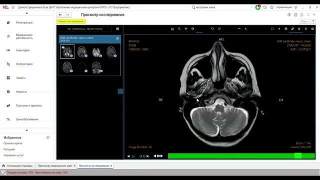 Интеграция с медицинским оборудованием в дополнительном модуле БИТ.Управление медицинским центром смотреть онлайн