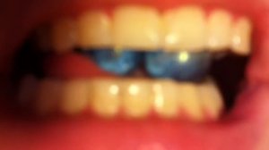 Swallowing more beads