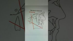 ТРГ по Шварцу, метод Твида, Ди Паоло (часть 1)