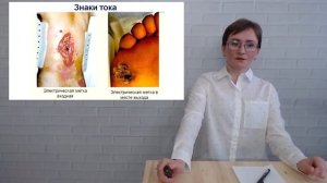 3 урок. Двести двадцать и больше – как помочь ребенку при ударе током?