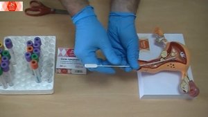 Пайпель внутриматочный JS. Схема использования. Джей Эс Украина