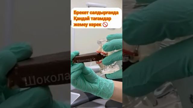 тис Тiстi брекет