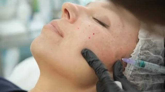 Мезотерапия | Мой любимый косметолог | Санкт-Петербург смотреть онлайн