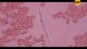 Бактерии и человеческий организм.