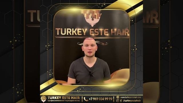 Пересадка волос в Москве +79690349999