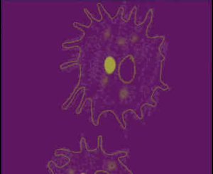 РАЗМНОЖЕНИЕ АМЁБЫ