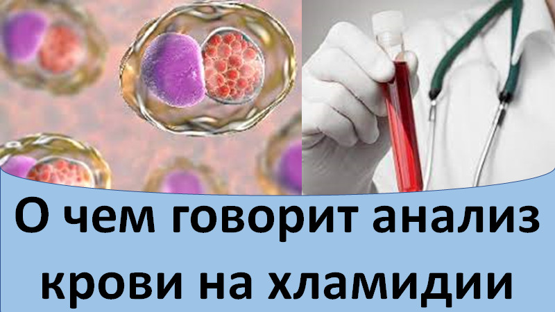 О чем говорит анализ крови на хламидии