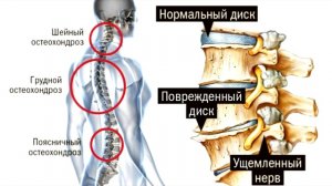 ОТВЕТЫ НА ВОПРОСЫ ПРЯМОЙ ЭФИР 10.12.17