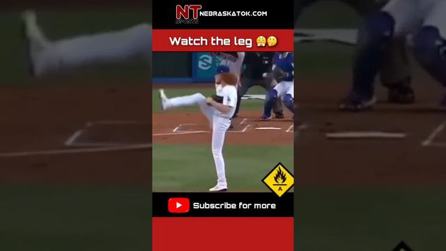 👀 Watch The Leg | Dustin May | Dodgers