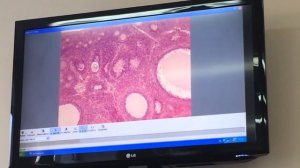 Гистология. Яичник и Желтое тело матка Яйцевод (Женская половая)