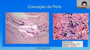 [CORTE] Coloração de Perls | Imersão PEESB Coloração Especial