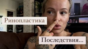 Вся правда о ринопластике 🫣 Рабочий день и неожиданные гости
