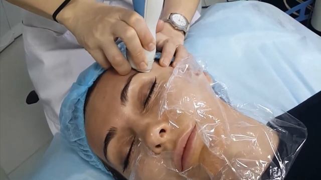 Фракционное лазерное омоложение, Palomar смотреть онлайн