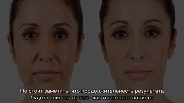 Фотоомоложение лица: что это