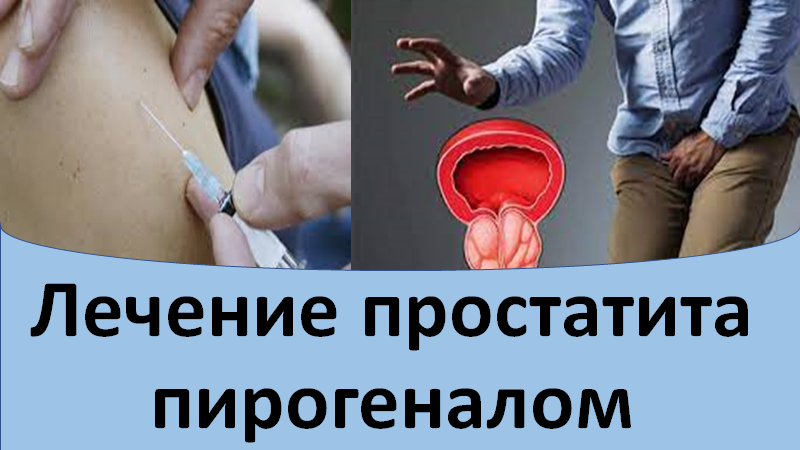 Лечение простатита пирогеналом