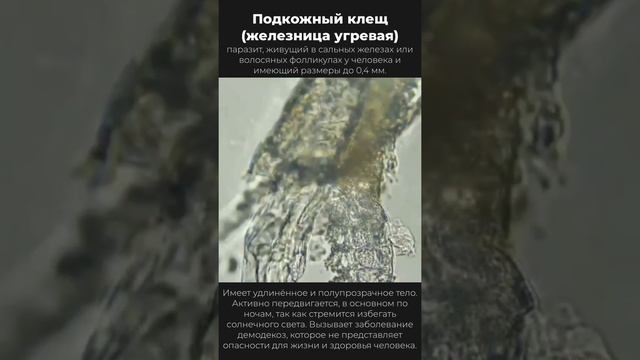 Demodex. Движение половозрелой особи клеща на корне человеческой ресничке.