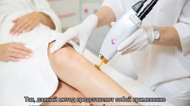 Виды лазерной эпиляции