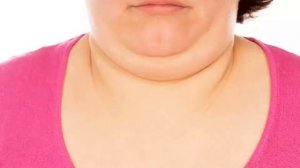 Второй подбородок   как с ним бороться