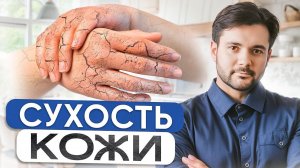 Вы забудете про СУХОСТЬ кожи и трещины! Как избавиться от сухости кожи рук навсегда?