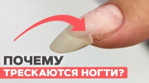 Как избавиться от трещин на ногтях? Работа одной банкой геля