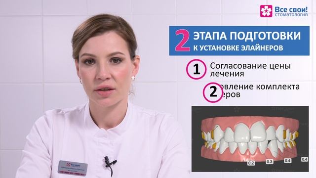 Каппы. Исправление прикуса и кривых зубов.Диагностика и подготовка к лечению на элайнерах. Ретейнер.