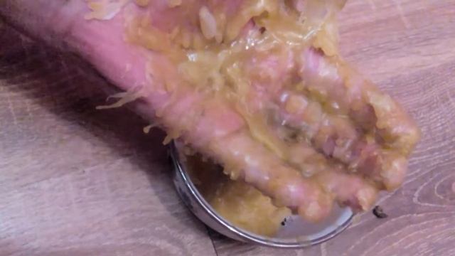 Что с моей рукой,покраснение, рука-свечка смотреть онлайн