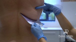 Криолиполиз Coolsculpting