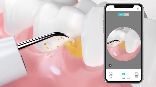 Портативный ультразвуковой скалер для чистки зубов Xiaomi Sunuo T11 Pro смотреть онлайн