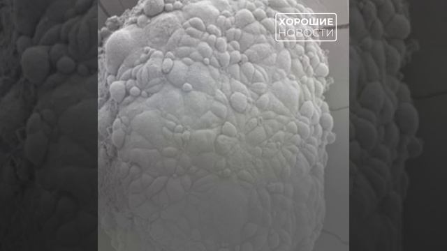 В Сеченовском университете провели уникальную операцию по восстановлению слуха